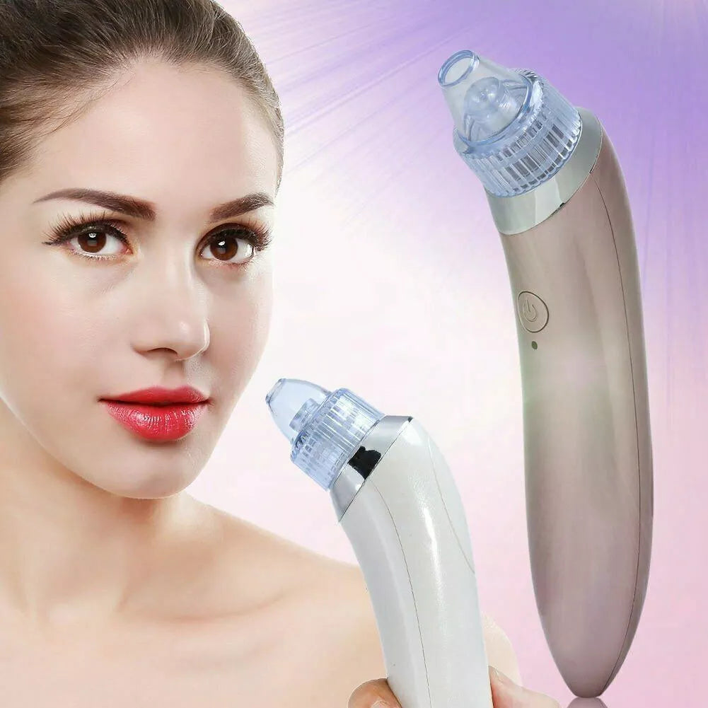 Blackhead Remover Vacuum Acne Cleaner – Deep Pore Cleansing for Flawless Skin